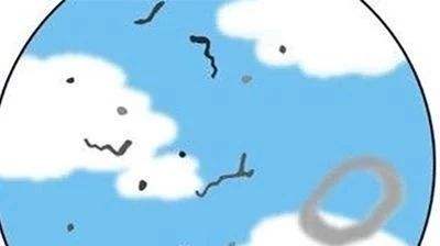 \